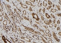 Invitrogen MAGEB6 Polyclonal Antibody 100 &mu;L; Unconjugated:Antibodies,