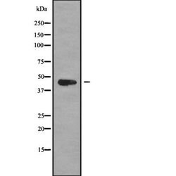 Invitrogen MAGEB6 Polyclonal Antibody 100 &mu;L; Unconjugated:Antibodies,