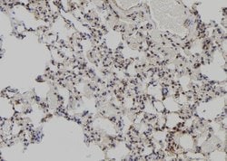 Invitrogen MAGED2 Polyclonal Antibody 100 &mu;L; Unconjugated:Antibodies,