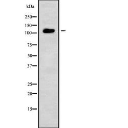 Invitrogen TSHZ3 Polyclonal Antibody 100 &mu;L; Unconjugated:Antibodies,