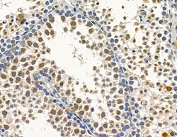 Invitrogen Cytomegalovirus UL97 Polyclonal Antibody 100 &mu;L; Unconjugated:Antibodies,