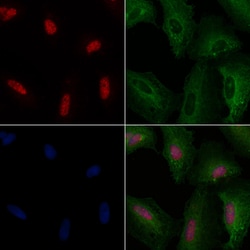 Invitrogen TRMT11 Polyclonal Antibody 100 &mu;L; Unconjugated:Antibodies,