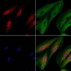 Invitrogen TRMT11 Polyclonal Antibody 100 &mu;L; Unconjugated:Antibodies,