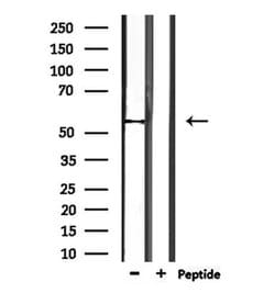 Invitrogen TRMT11 Polyclonal Antibody 100 &mu;L; Unconjugated:Antibodies,