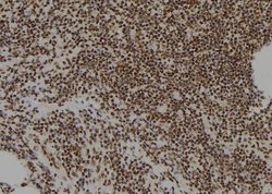 Invitrogen ZNF227 Polyclonal Antibody 100 &mu;L; Unconjugated:Antibodies,