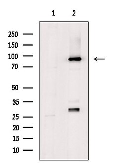 Invitrogen ZNF227 Polyclonal Antibody 100 &mu;L; Unconjugated:Antibodies,