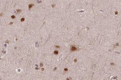 Invitrogen ASPM Polyclonal Antibody 100 &mu;L; Unconjugated:Antibodies,