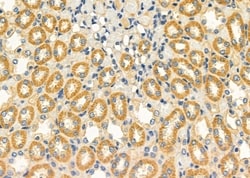 Invitrogen ASPM Polyclonal Antibody 100 &mu;L; Unconjugated:Antibodies,