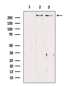 Invitrogen ASPM Polyclonal Antibody 100 &mu;L; Unconjugated:Antibodies,