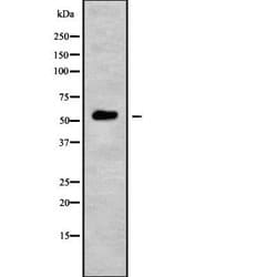 Invitrogen POLM Polyclonal Antibody 100 &mu;L; Unconjugated:Antibodies,