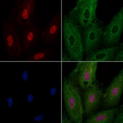 Invitrogen NOLA1 Polyclonal Antibody 100 &mu;L; Unconjugated:Antibodies,