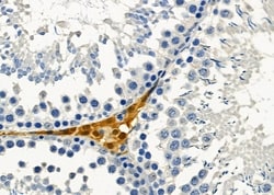 Invitrogen NOLA1 Polyclonal Antibody 100 &mu;L; Unconjugated:Antibodies,