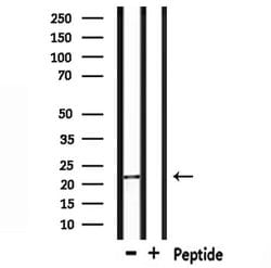 Invitrogen NOLA1 Polyclonal Antibody 100 &mu;L; Unconjugated:Antibodies,