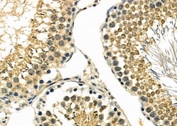 Invitrogen JDP2 Polyclonal Antibody 100 &mu;L; Unconjugated:Antibodies,