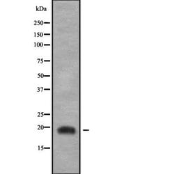 Invitrogen JDP2 Polyclonal Antibody 100 &mu;L; Unconjugated:Antibodies,