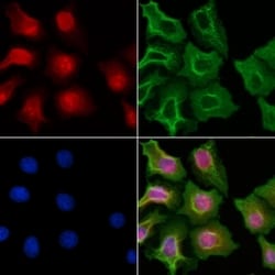 Invitrogen CDY1 Polyclonal Antibody 100 &mu;L; Unconjugated:Antibodies,