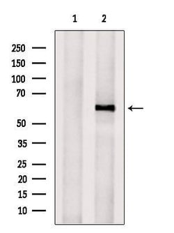 CYP11B2 Polyclonal Antibody:Antibodies, Polyclonal