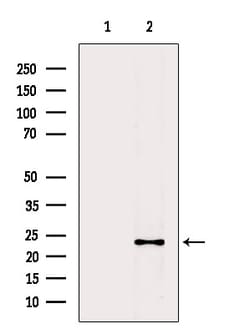 Invitrogen&trade;&nbsp;CYBA Polyclonal Antibody