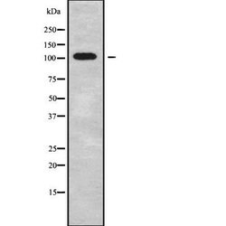Invitrogen FBF1 Polyclonal Antibody 100 &mu;L | Buy Online | Invitrogen&trade; | Fisher Scientific