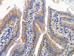 Invitrogen IFNLR1 Polyclonal Antibody 100 &mu;L; Unconjugated:Antibodies,