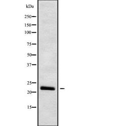 IFN Omega Polyclonal Antibody:Antibodies, Polyclonal