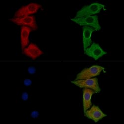 IFN Omega Polyclonal Antibody:Antibodies, Polyclonal