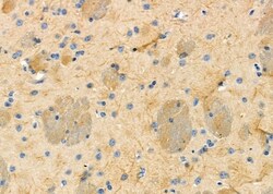 Invitrogen IGFL2 Polyclonal Antibody 100 &mu;L; Unconjugated:Antibodies,