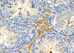 Invitrogen IGFL2 Polyclonal Antibody 100 &mu;L; Unconjugated:Antibodies,