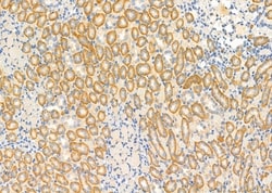 Invitrogen IGFL2 Polyclonal Antibody 100 &mu;L; Unconjugated:Antibodies,