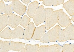 Invitrogen IGFL2 Polyclonal Antibody 100 &mu;L; Unconjugated:Antibodies,