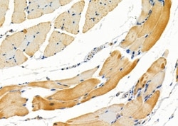 Invitrogen IGFL2 Polyclonal Antibody 100 &mu;L; Unconjugated:Antibodies,