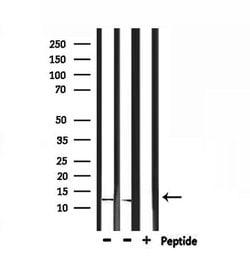 Invitrogen IGFL2 Polyclonal Antibody 100 &mu;L; Unconjugated:Antibodies,
