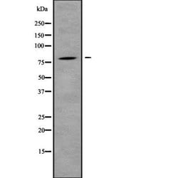 Invitrogen IL31RA Polyclonal Antibody 100 &mu;L; Unconjugated:Antibodies,