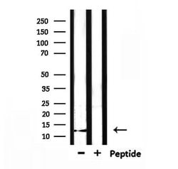 Invitrogen XCL1/XCL2 Polyclonal Antibody 100 &mu;L; Unconjugated:Antibodies,