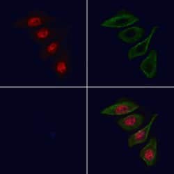 Invitrogen MCM8 Polyclonal Antibody 100 &mu;L; Unconjugated:Antibodies,