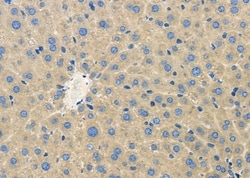 Invitrogen CYP4Z1/CYP4Z2P Polyclonal Antibody 100 &mu;L; Unconjugated:Antibodies,