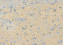 Invitrogen CYP4Z1/CYP4Z2P Polyclonal Antibody 100 &mu;L; Unconjugated:Antibodies,