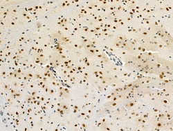 Invitrogen NPR2 Polyclonal Antibody 100 &mu;L; Unconjugated:Antibodies,