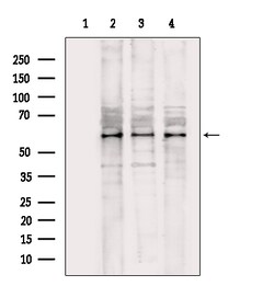 Invitrogen CAMKK1 Polyclonal Antibody 100 &mu;L; Unconjugated:Antibodies,
