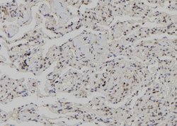 Invitrogen CK1 gamma-3 Polyclonal Antibody 100 &mu;L; Unconjugated:Antibodies,