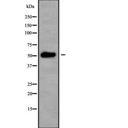 Invitrogen CK1 gamma-3 Polyclonal Antibody 100 &mu;L; Unconjugated:Antibodies,