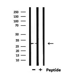 Invitrogen TSSK6 Polyclonal Antibody 100 &mu;L; Unconjugated:Antibodies,
