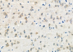 Invitrogen TXK Polyclonal Antibody 100 &mu;L; Unconjugated:Antibodies,