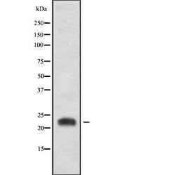 Invitrogen CD300b Polyclonal Antibody 100 &mu;L; Unconjugated:Antibodies,