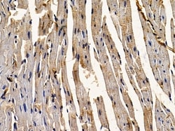 Invitrogen Sclerostin Polyclonal Antibody 100 &mu;L | Buy Online | Invitrogen&trade; | Fisher Scientific