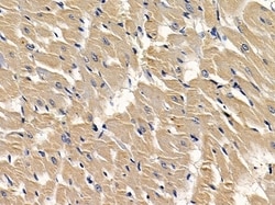 Invitrogen Sclerostin Polyclonal Antibody 100 &mu;L | Buy Online | Invitrogen&trade; | Fisher Scientific