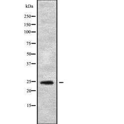 Invitrogen Sclerostin Polyclonal Antibody 100 &mu;L | Buy Online | Invitrogen&trade; | Fisher Scientific