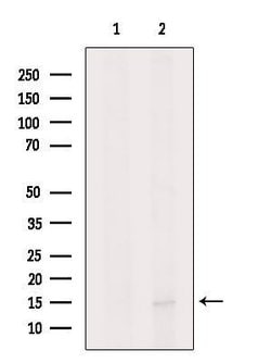 Invitrogen CXCL17 Polyclonal Antibody 100 &mu;L; Unconjugated:Antibodies,