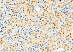 Invitrogen LINGO2 Polyclonal Antibody 100 &mu;L | Buy Online | Invitrogen&trade; | Fisher Scientific