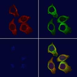 Invitrogen PSG3 Polyclonal Antibody 100 &mu;L; Unconjugated:Antibodies,